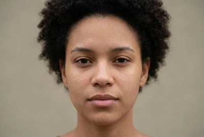 Antes e depois de skincare